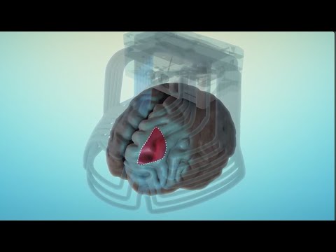 Transcranial Magnetic Stimulation for Depression and Anxiety