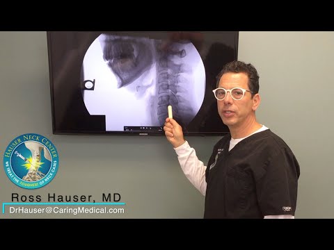 Gerd Brain Fog and Its Effects on Mental Clarity