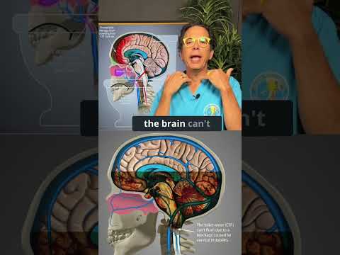 Managing Stiff Neck and Brain Fog for Better Mental Clarity