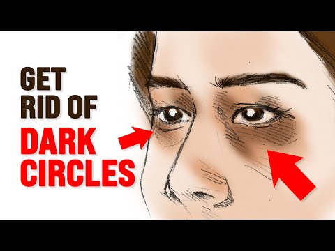 The Connection Between Depression and Dark Circles Under Eyes