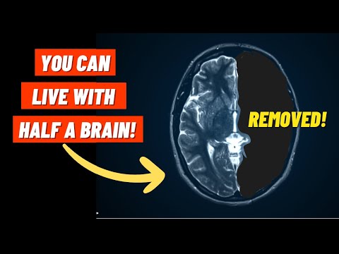 Brain Plasticity's Role in Mental Health Recovery and Growth