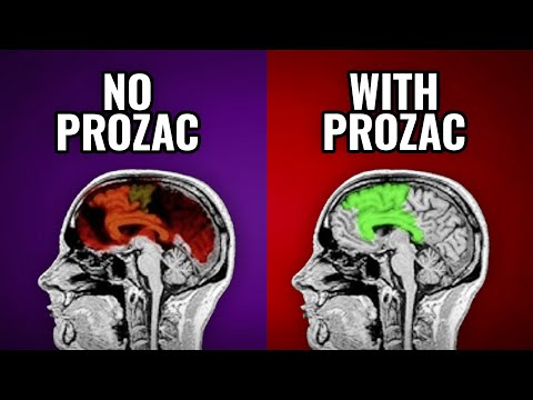Prozac Bruising and Its Psychological Implications