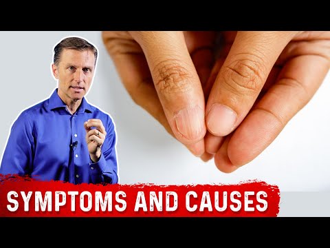 Low Iron Levels and Their Effect on Mental Clarity