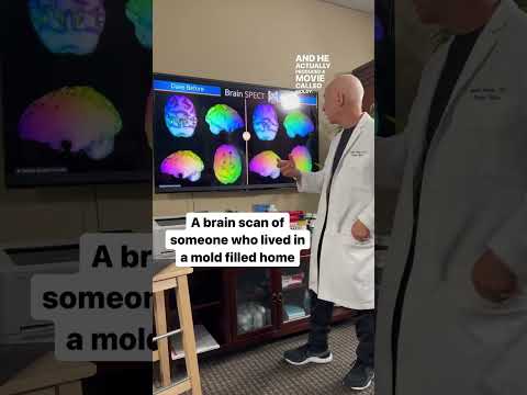 Mold Exposure and Its Connection to Mental Clarity Issues