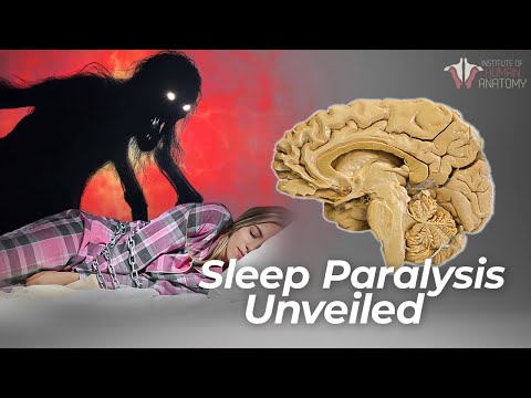 The Psychological Toll of Sleep Paralysis Nightmares