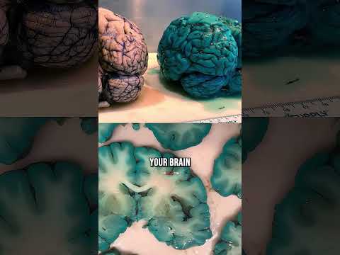 Methylene Blue and Its Role in Alleviating Brain Fog