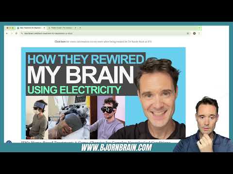 tDCS and Its Role in Alleviating Depression Symptoms