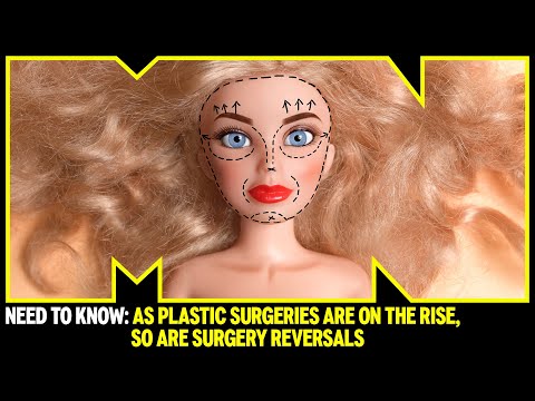 Beauty Standards on Social Media and Their Mental Health Effects