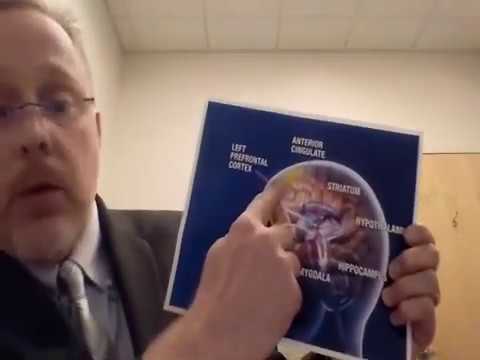 Neurostar: A New Approach to Treating Depression