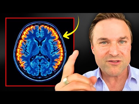 Addressing Brain Fog: Insights from Dr. Berg’s Approach