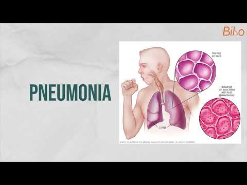 Coping with Pneumonia Through Breathwork and Mental Resilience