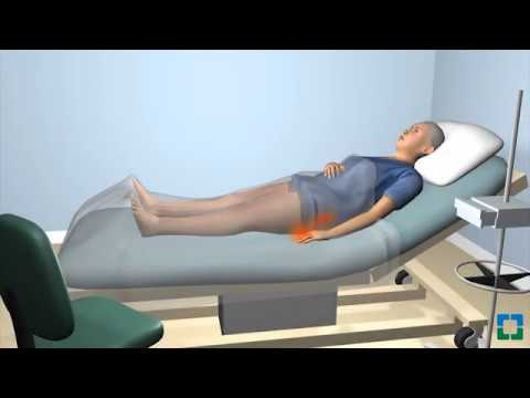 Psychological Strategies for Preventing Pressure Ulcers in Care