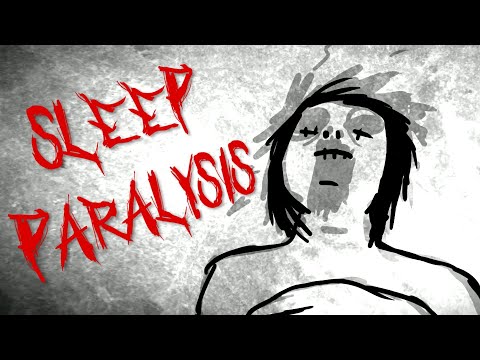 Mind-Body Disconnect: The Psychology of Awake Paralysis