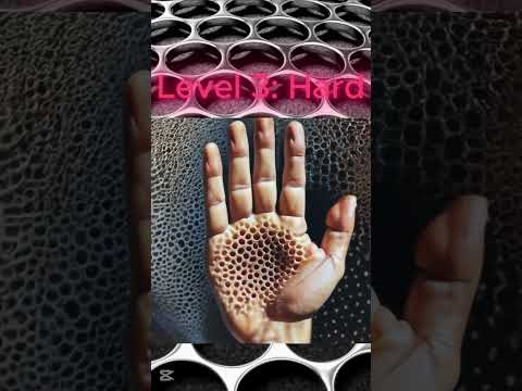 Ten Fascinating Phobias That Shape Human Experience